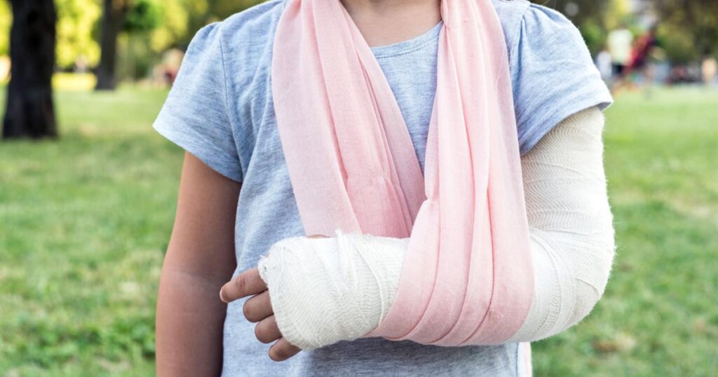 What To Expect After You Break Your Arm Penticton Physiotherapy